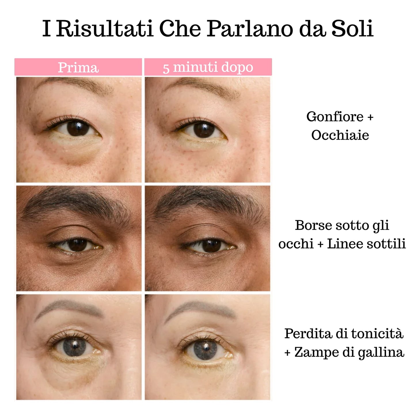 Lifting Temporaneo Contorno Occhi