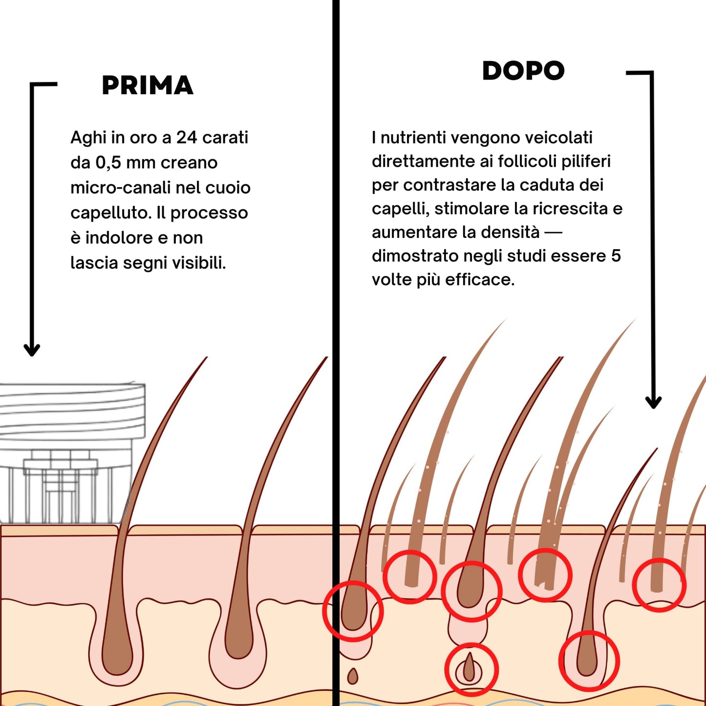 AlphaInfuse | Sistema per la ricrescita dei capelli