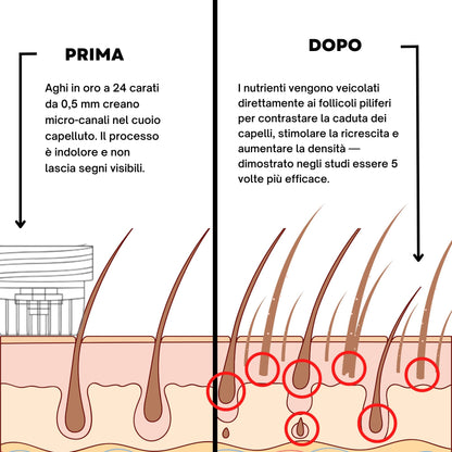 AlphaInfuse | Sistema per la ricrescita dei capelli