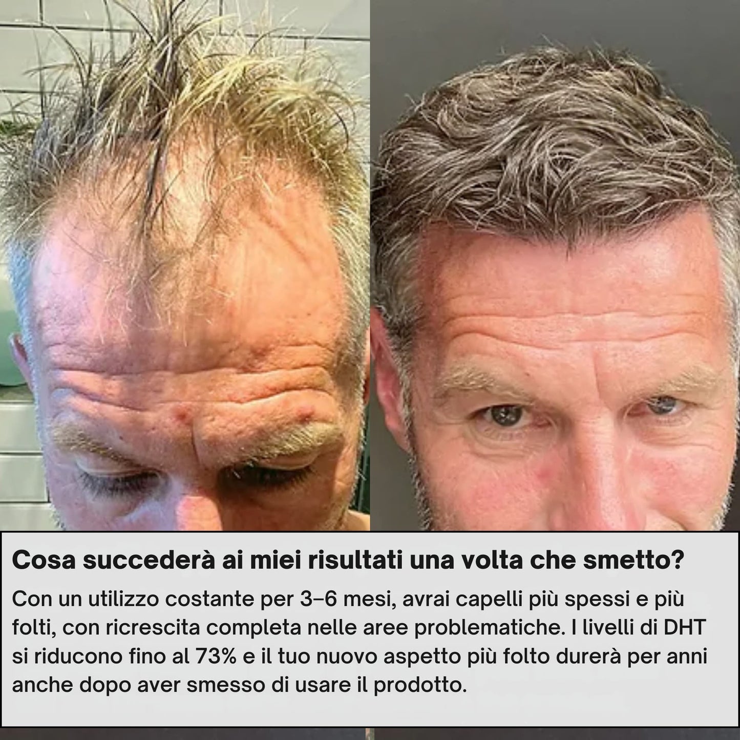 AlphaInfuse | Sistema per la ricrescita dei capelli