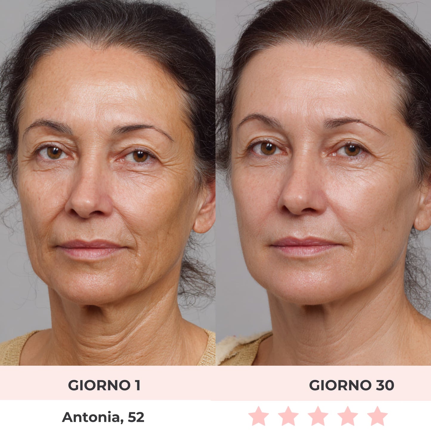 DermaGlide | Scolpitore Facciale LED 7-in-1