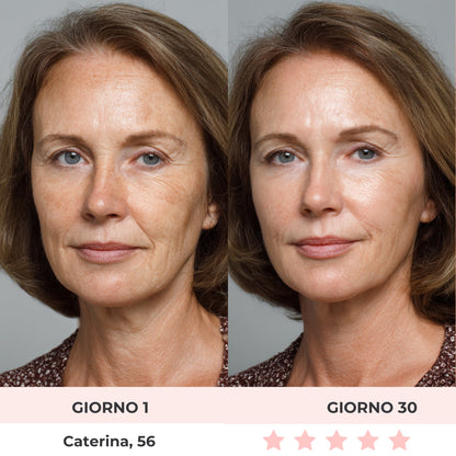 DermaGlide | Scolpitore Facciale LED 7-in-1