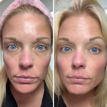 Dermaglide™ CumaBalm