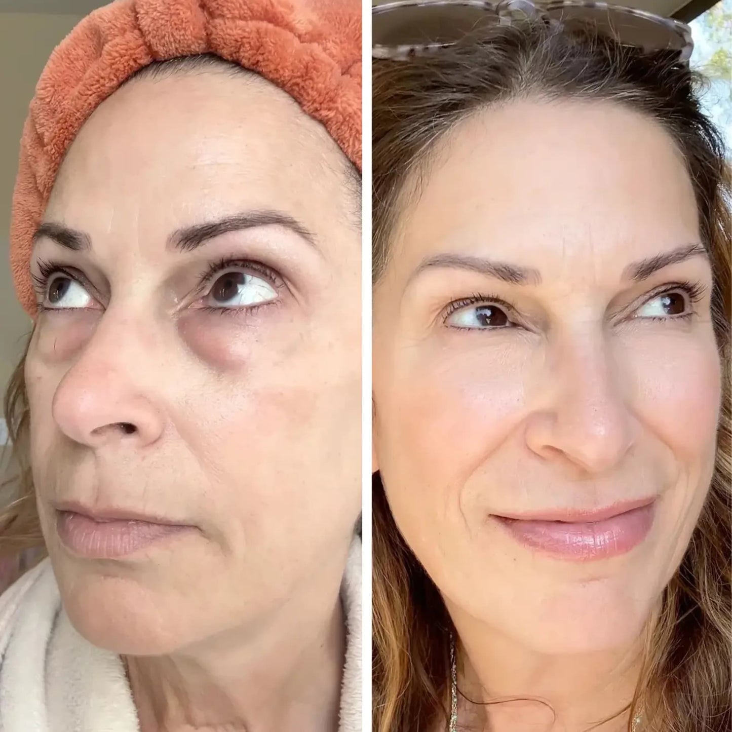 Dermaglide™ CumaBalm