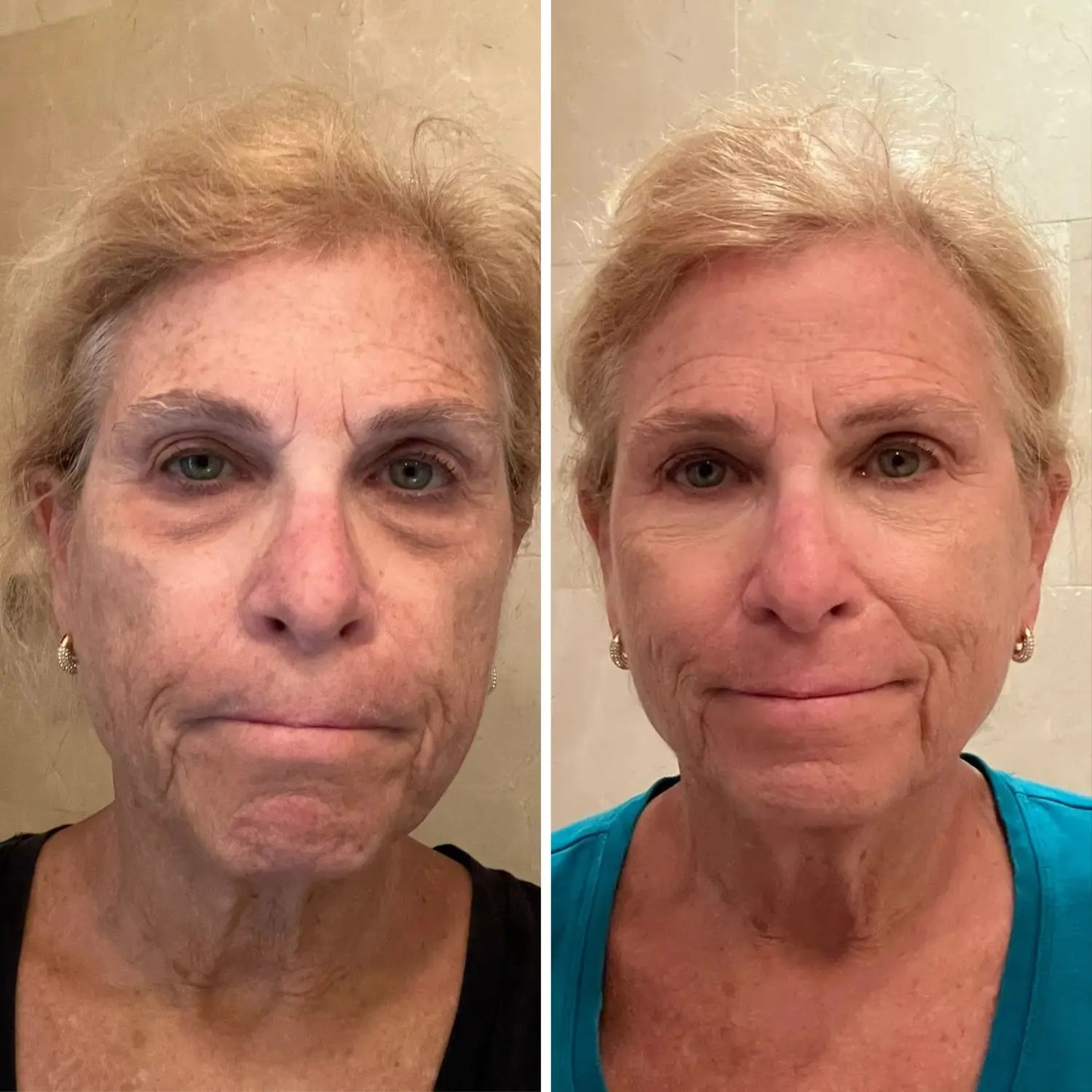 Dermaglide™ CumaBalm